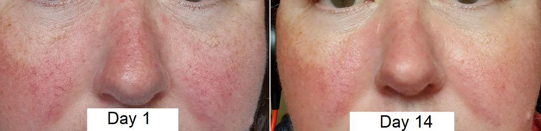 Customer photo review of Repair, Healing & Relaxing Set