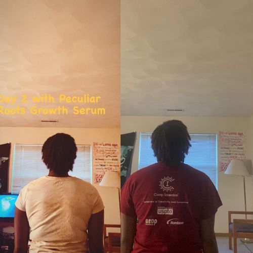 Customer photo review of Hair Growth Serum | 4 oz