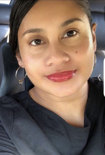 Customer photo review of LOVESKIN Dry/ Mature Skincare Ritual