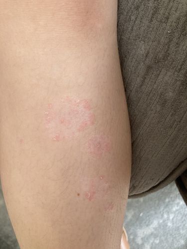 Customer photo review of Multi Strain Biotic