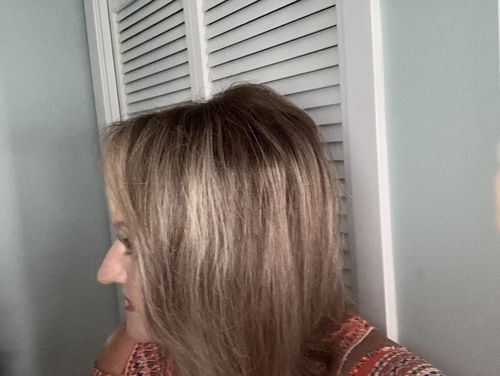 Customer photo review of Full Shine Lace Human Hair Wig Toppers 13cm*13cm For Women Hair Loss Balayage #4/27/4