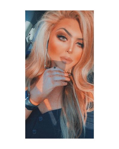 Customer photo review of Quartz Prescription Contact Lenses