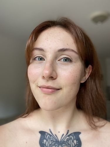 Customer photo review of Freckle Stain