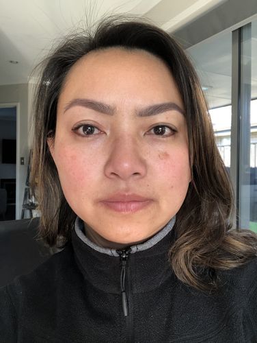 Customer photo review of LOVESKIN Dry/ Mature Skincare Ritual