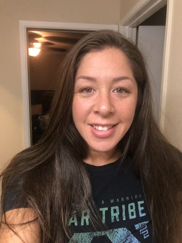 Customer photo review of Neala Green Contact Lenses(12 months wear)