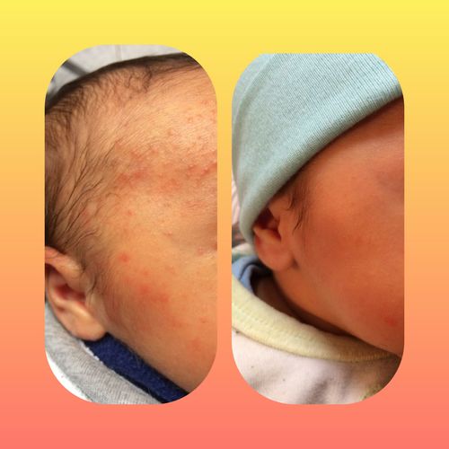Customer photo review of Emulsión Recuperadora