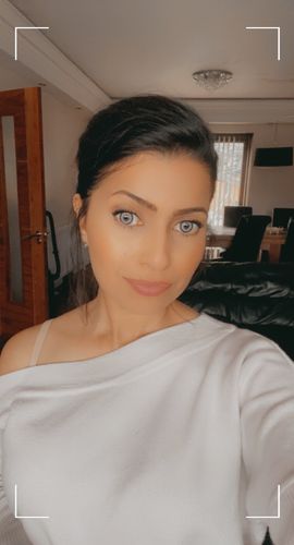 Customer photo review of Citha Gray Contact Lenses(12 months wear)