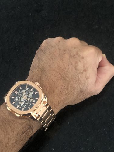 Customer photo review of OTUS² - ROSE