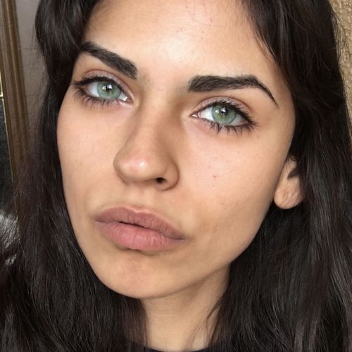 Customer photo review of Alpha Green Contact Lenses(12 months wear)