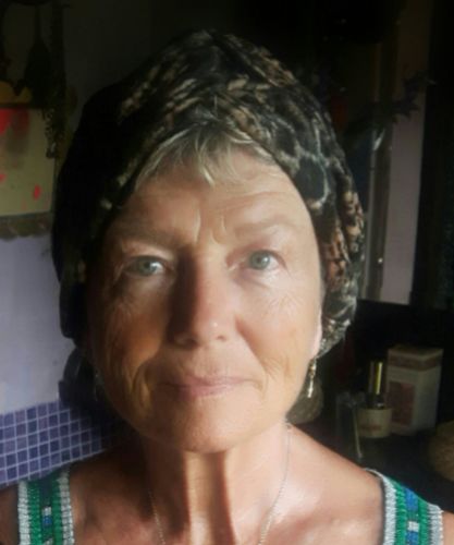 Customer photo review of Acido Ialuronico Puro - Idratante, Rimpolpante, Antirughe, 30ml