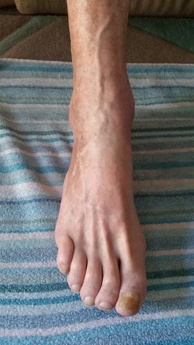 Customer photo review of Intensive Night Balm