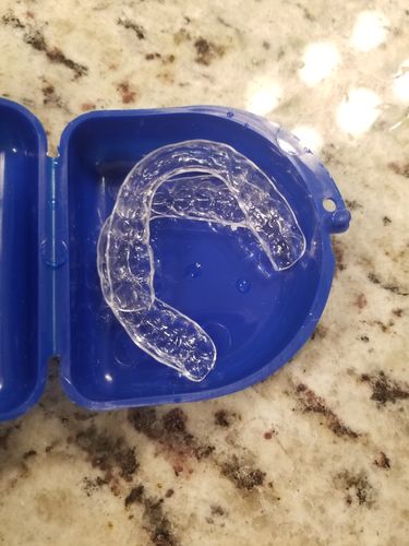 Customer photo review of Upper and Lower Retainers