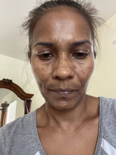 Customer photo review of Glow Getter