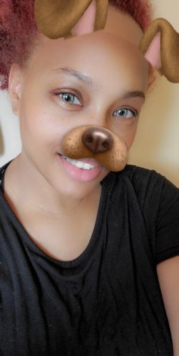 Customer photo review of Citha Gray Contact Lenses(12 months wear)