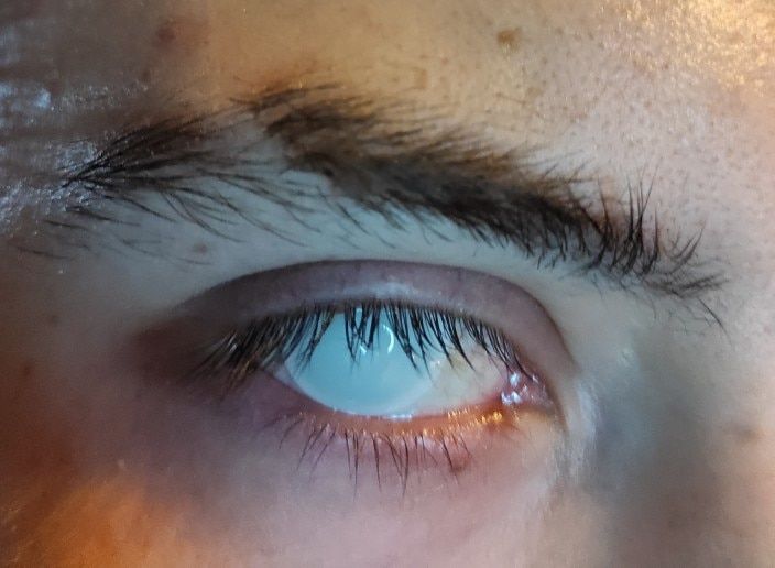 Customer photo review of White Mesh Contacts