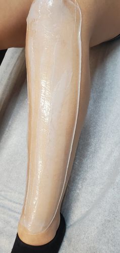 Customer photo review of Signature Series Hair Removal Wax