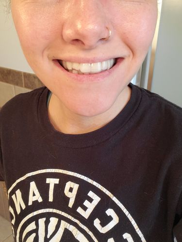 Customer photo review of Impression Kit (Ships every 3 Months)