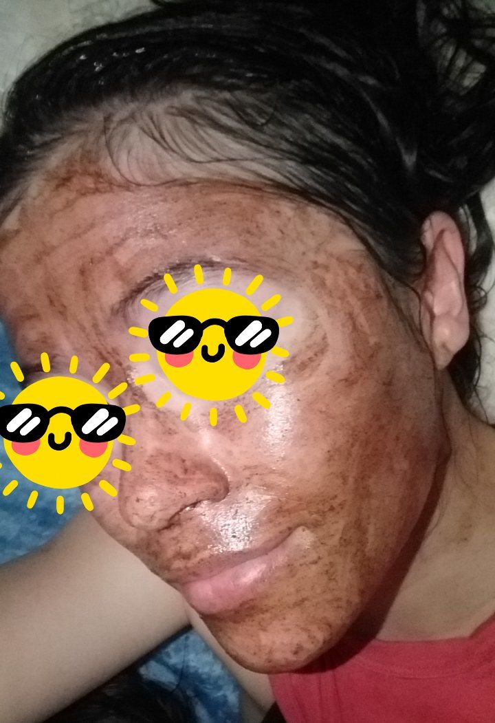 Customer photo review of Mask & Scrub / Mascarilla - Exfoliante de Tepezcohuite