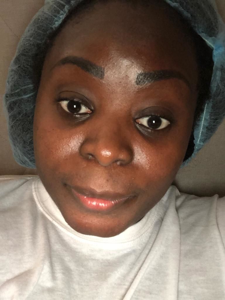Customer photo review of Fair & White SoWhite! Essentials Kit