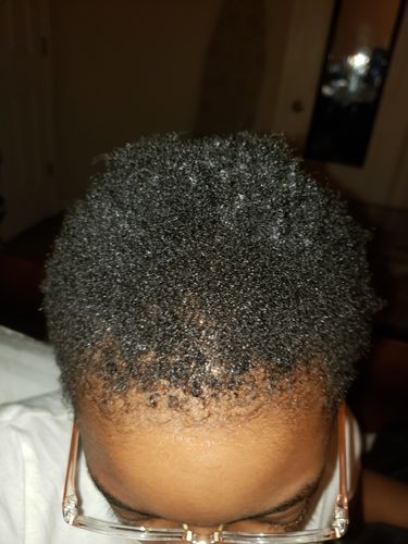Customer photo review of Kid's Super healthy Hair kit
