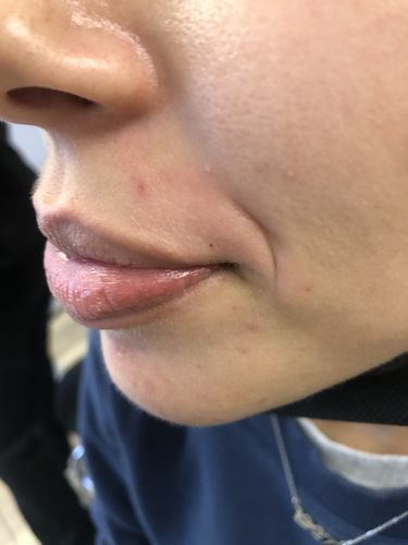 Customer photo review of Large Capacity Professional Wax Warmer 5.5LB Honey Pot