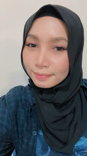 Customer photo review of Add Choco (2pcs) (Buy 1 Get 1 Free) 1Month G.DIA 13.6mm