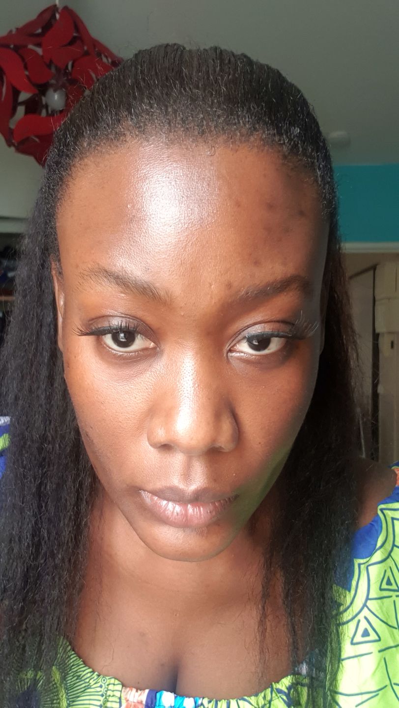 Customer photo review of Good Skin - 3 mois