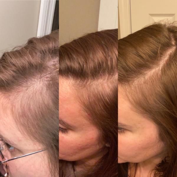 Customer photo review of SUBLIMATEUR® - 120 GÉLULES
