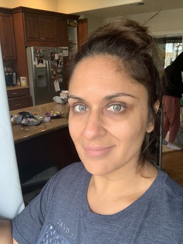 Customer photo review of Citha Hazel Contact Lenses(12 months wear)