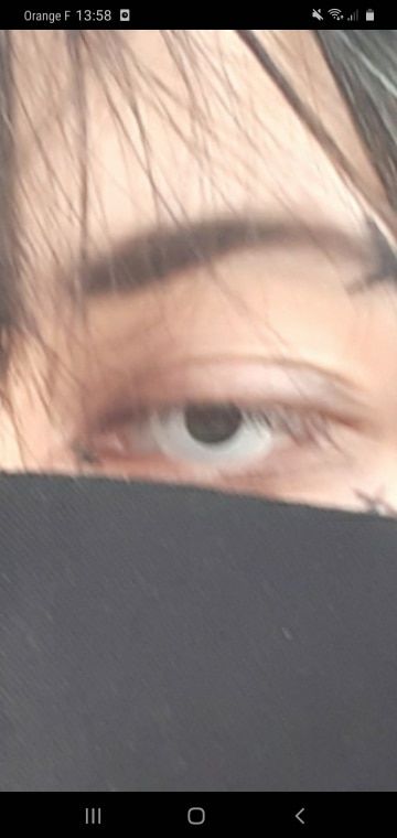 Customer photo review of Whiteout Lenses