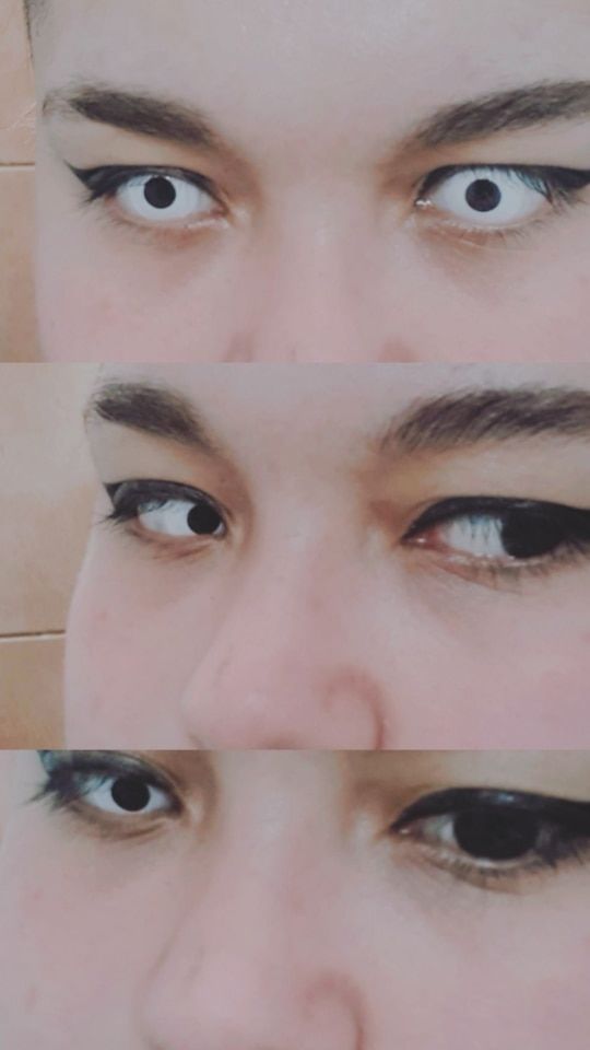 Customer photo review of Whiteout Lenses
