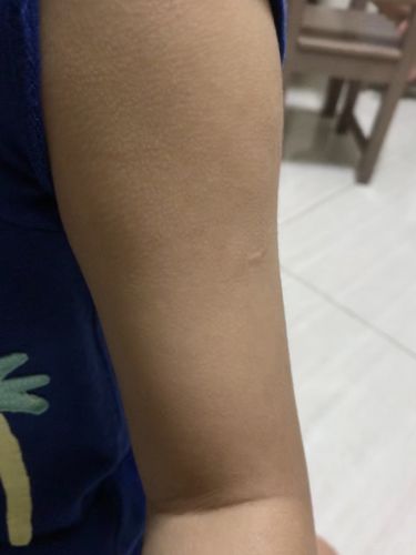 Customer photo review of Coco 濕疹修護霜 80ml