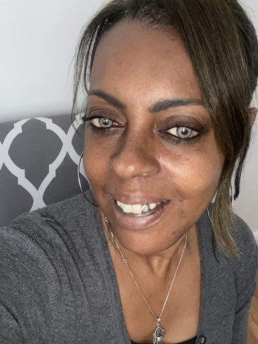 Customer photo review of Citha Hazel Contact Lenses(12 months wear)