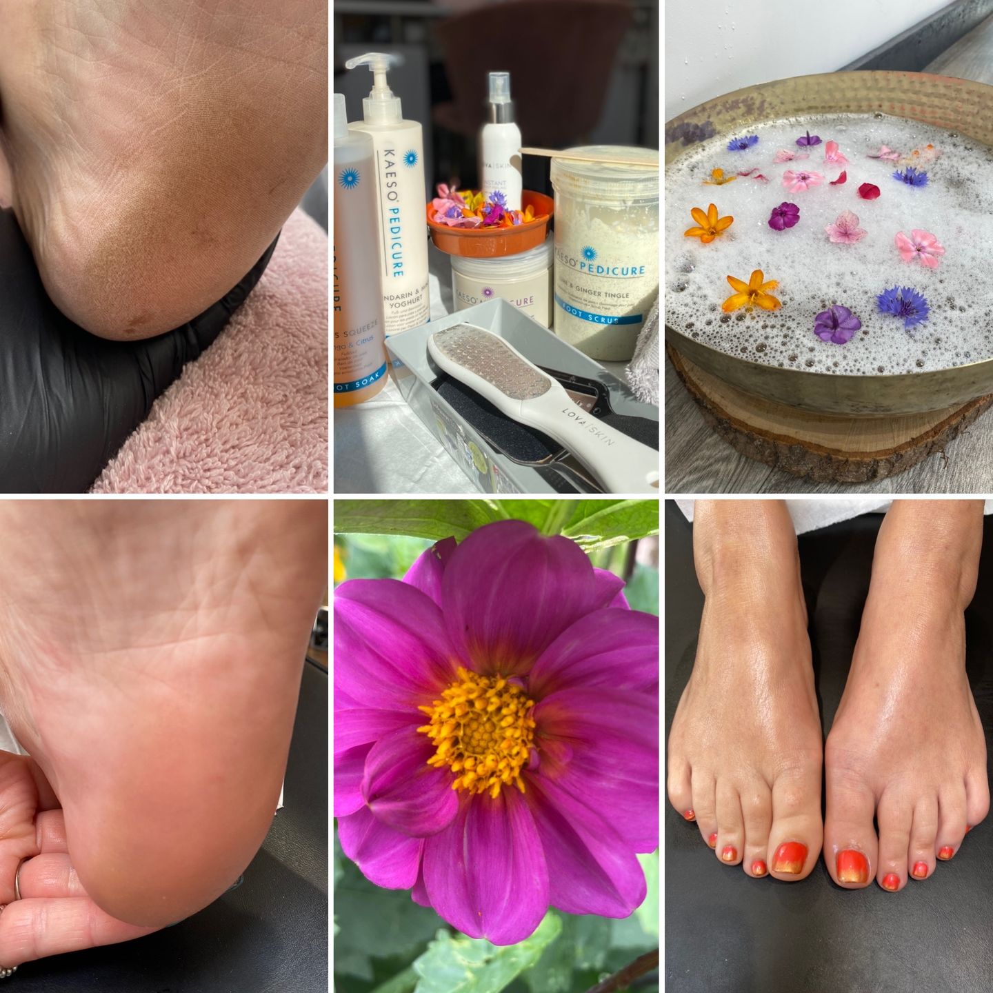 Customer photo review of LOVASKIN INSTANT FOOT PEEL Spray bottle 2.5 fl oz - 25 uses or under 2 $ to have beautiful feet