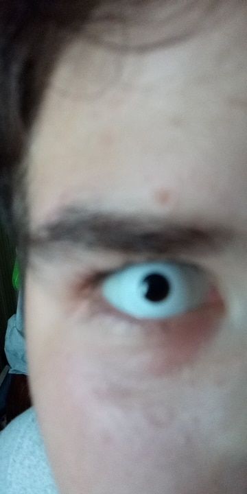 Customer photo review of Whiteout Lenses
