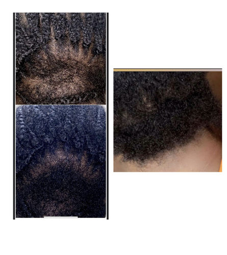 Customer photo review of BACK IN LIMITED STOCK 8/15/21 | BEST SELLER! | Chad and India’s Root to Tip Bundle| 3 sizes to choose from