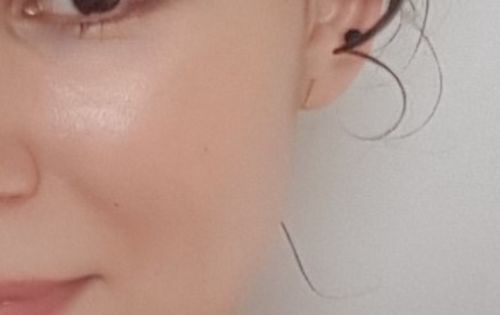 Customer photo review of Niacid