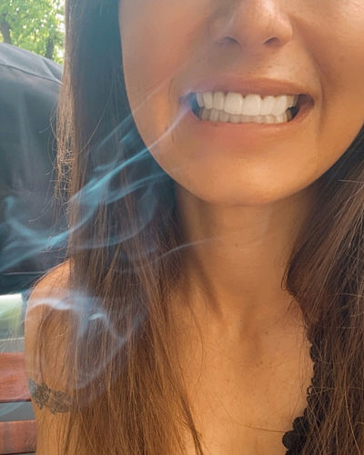 Customer photo review of Tooth-Veneer