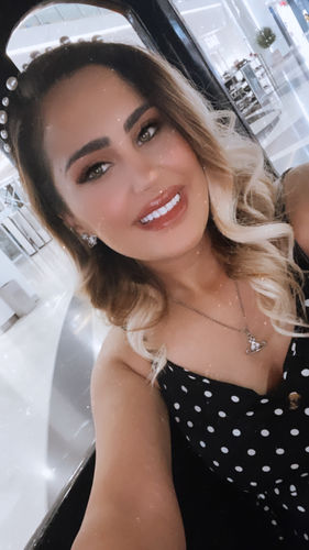 Customer photo review of Black Edition – Charcoal Tooth Polish