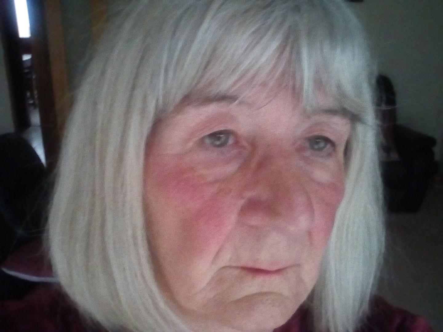 Customer photo review of Healing Miracle Cream