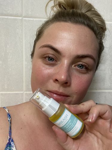 Customer photo review of I AM RADIANT FACE OIL  (NEW & IMPROVED)