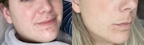 Customer photo review of Savon au lait de chèvre parfumé au musc tahara • peaux mixtes à grasses