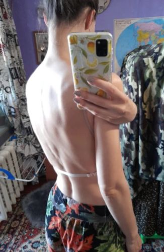 Customer photo review of MidnightMoon™ Backless Bra | Känn dig nonchalant och sexig i alla toppar eller klänningar med låg rygg | tillfälligt 1+1 GRATIS