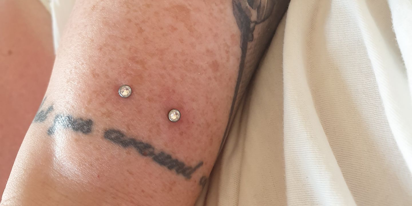 Customer photo review of NeilMed Sterile Saline Piercing Aftercare