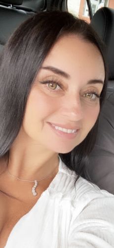 Customer photo review of Neala Green Contact Lenses(12 months wear)