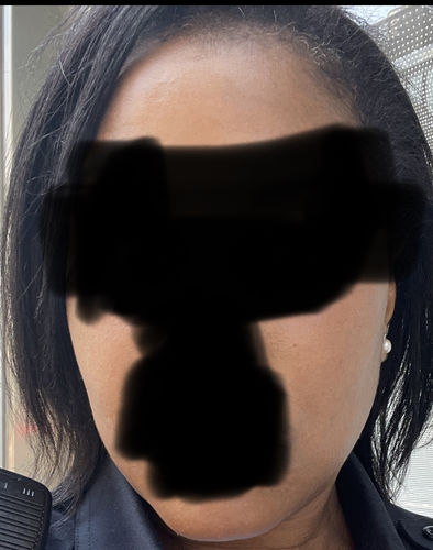 Customer photo review of Combo 5- Liposomal Set