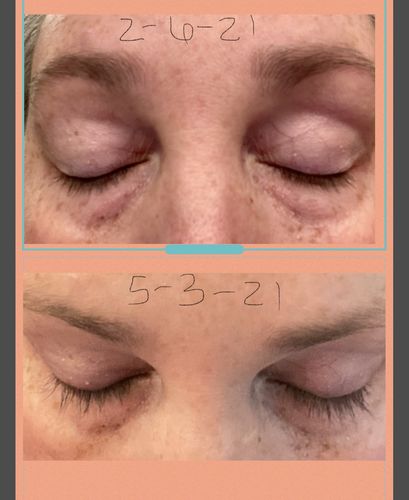 Customer photo review of The Lash Bond