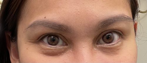 Customer photo review of TTDeye Love Me Pink Colored Contact Lenses