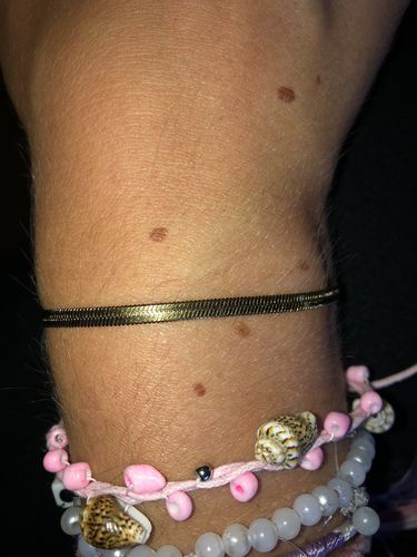 Customer photo review of Sleek Armband