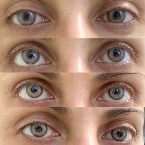 Customer photo review of Citha Hazel Contact Lenses(12 months wear)